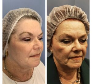 d797c834-a045-4854-9346-1cfc1484cc3a