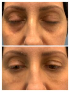 fdd7c1d0-a217-4ab5-a7ba-9d049cfee4c8